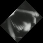 eLXg 